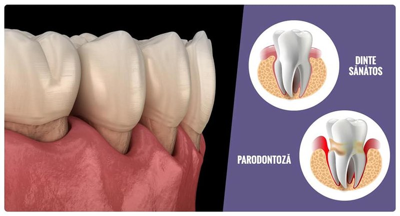 Belous Dental Group - Clinica Stomatologica